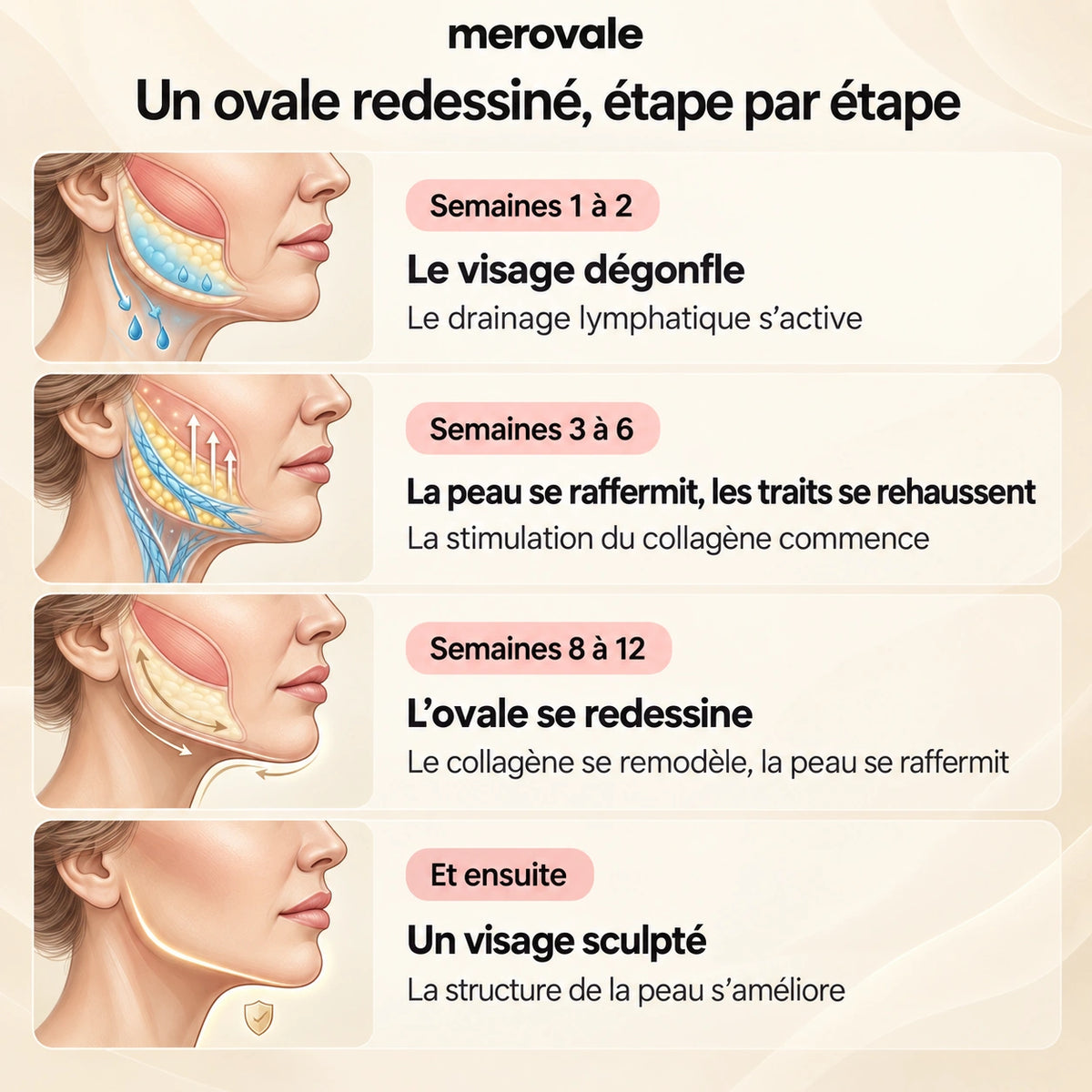 Merovale — Les étapes.