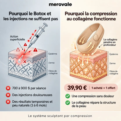 Merovale — Le comparatif.