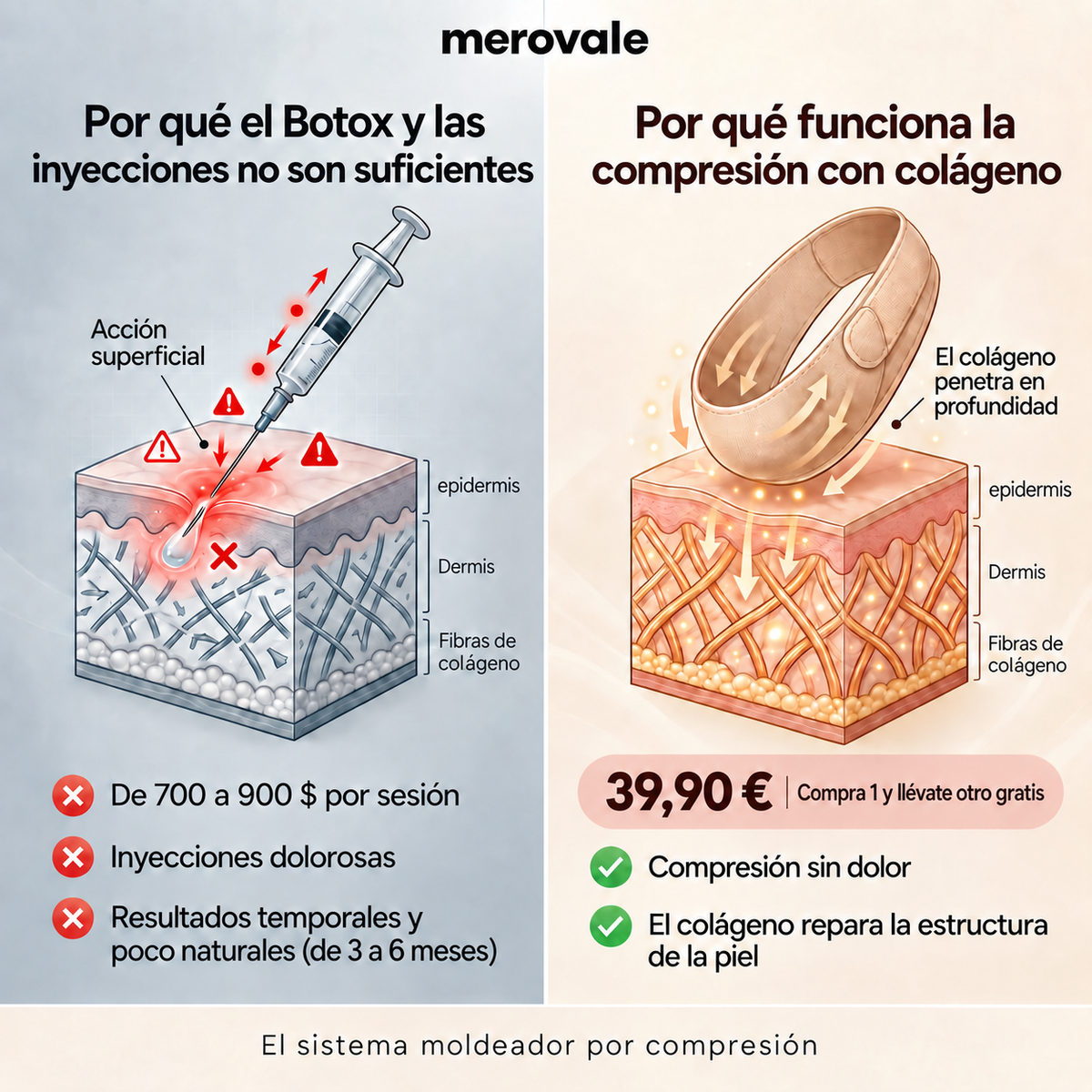 Merovale — Comparación.