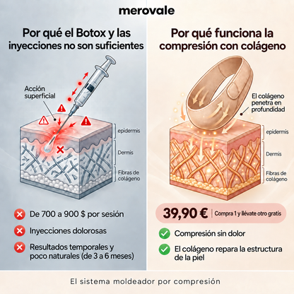 Merovale — Comparación.